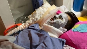 Việt kiều bị tạt acid và bị cắt gân chân, buôn lậu sừng tê giác bị bắt