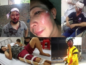 Việt Nam bị tố vi phạm nhân quyền và đàn áp người đồng chính kiến
