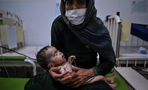 Điểm báo Pháp - Trẻ em Afghanistan có nguy cơ chết đói